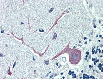 IHC testing of FFPE human cerebellum tissue with OSBPL1A antibody at 5ug/ml. Steamed antigen retrieval with citrate buffer pH 6, AP-staining.