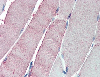 IHC testing of FFPE human skeletal muscle tissue with OSBPL1A antibody at 5ug/ml. Steamed antigen retrieval with citrate buffer pH 6, AP-staining.