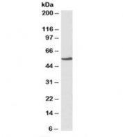 Western blot testing of HepG2 lysate with NR5A2 antibody at 1ug/ml. Predicted molecular weight: ~56/61kDa (isoforms 1/2).