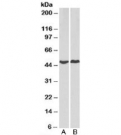 Western blot testing of human A) HeLa and B) MCF7 cell lysate with PRKACA antibody at 2ug/ml. Predicted molecular weight of isoforms: 38~47kDa.