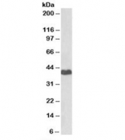 Western blot testing of human HeLa cell lysate with PRKACA antibody at 2ug/ml. Predicted molecular weight of isoforms: 38~47kDa.