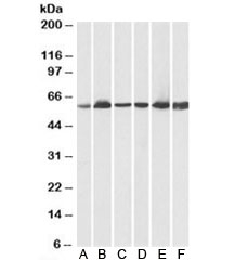 Western blot testing of human A) heart, B) kidney, C) liver lysates and pig D) heart, E) kidney, F) liver lysates using HSP60 antibody at 0.03ug/ml. Predicted molecular weight: ~61kDa.