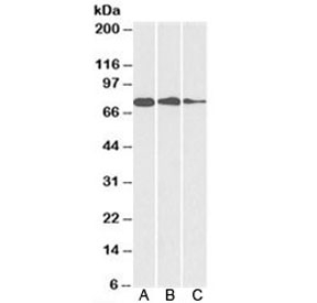 Western blot testing of A) HepG2, B) HeLa and C) MCF7 cell lysate with GRP78 antibody at 0.1ug/ml. Predicted molecular weight: ~73kDa, but routinely observed at 70-78kDa.