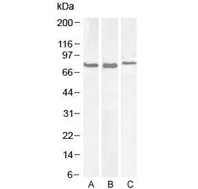 Western blot testing of A) mouse liver, B) mouse testis and C) rat brain lysate with GRP78 antibody at 0. 1ug/ml. Predicted molecular weight: ~73 kDa, routinely observed at 70-78 kDa.