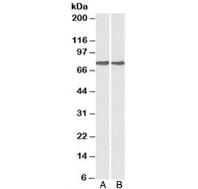 Western blot testing of A) HepG2 and B) MCF7 cell lysate with GRP78 antibody at 0.1ug/ml. Predicted molecular weight: ~73kDa, but routinely observed at 70-78kDa.