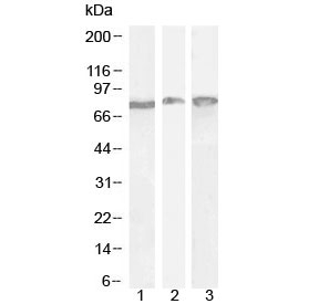 Western blot testing of 1) mouse liver and 2) mouse testis lysate with GRP78 antibody at 0.3ug/ml and 3) rat brain lysate with GRP78 antibody at 0.5ug/ml. Expected molecular weight: 70-78 kDa.