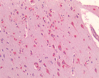 IHC testing of FFPE human cortex tissue with GRP78 antibody at 5ug/ml. Required HIER: steamed antigen retrieval with pH6 citrate buffer; AP-staining.