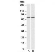 Western blot testing of A) HepG2 and B) MCF7 cell lysate with GRP78 antibody at 0.1ug/ml. Predicted molecular weight: ~73 kDa, but routinely observed at 70-78 kDa.