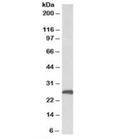 Western blot testing of human adipose tissue lysate with CFD antibody at 1ug/ml. Predicted molecular weight: ~27kDa.