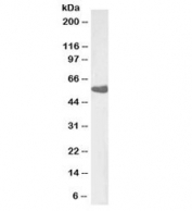 Western blot testing of human lung lysate with Thromboxane A2 Receptor antibody at 0.03ug/ml. Predicted molecular weight: ~44/55-60 kDa (unmodified/glycosylated).