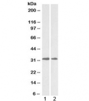 Western blot testing of human 1) heart and 2) placenta lysate with LOX antibody at 0.5ug/ml. Expected molecular weight: ~47 kDa (unprocessed/unmodified), ~50 kDa (glycosylated), ~32 kDa (processed form).