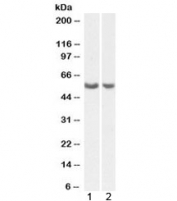 Western blot testing of human 1) lung and 2) ovary lysate with PTGIS antibody at 0.5ug/ml. Expected molecular weight: ~57 kDa.