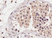 IHC testing of FFPE human testis tissue with SLC22A16 antibody at 4ug/ml. HIER: steamed with pH9 Tris/EDTA buffer, HRP-staining. Membranous staining of the seminiferous tubules is seen.