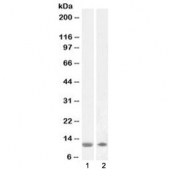 Western blot testing of human 1) olfactory bulb and 2) cerebellum lysate with S100 beta antibody at 1ug/ml. Predicted molecular weight ~11 kDa.