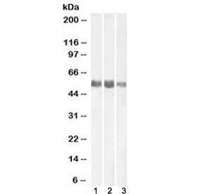 Western blot testing of human 1) kidney, 2) lung and 3) adrenal gland lysate with Alkaline Phosphatase antibody (tissue-nonspecific) at 0.1ug/ml. Predicted molecular weight ~57 kDa.