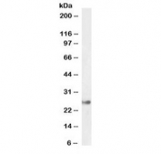 Western blot testing of human liver lysate with GSTA4 antibody at 0.3ug/ml. Predicted molecular weight ~26 kDa.