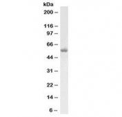 Western blot testing of human testis lysate with LCAT antibody at 1ug/ml. Observed molecular weight: 50~75 kDa depending on glycosylation level.