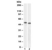 Western blot testing of human 1) Jurkat and 2) K562 cell lysate with DPF2 antibody at 1ug/ml. Predicted molecular weight: ~44 kDa, routinely observed at ~50 kDa.