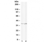 Western blot testing of 1) human cerebellum and 2) rat brain lysate with DLX2 antibody at 1ug/ml. Predicted molecular weight ~34 kDa.