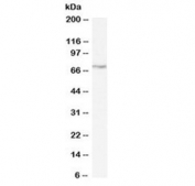Western blot testing of rat pancreas lysate with LIMK2 antibody at 0.3ug/ml. Predicted molecular weight ~72 kDa (LIMK2a) and ~69 kDa (LIMK2b).