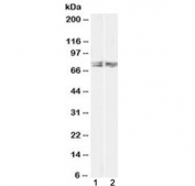Western blot testing of 1) human HeLa and 2) mouse NIH3T3 lysate with LIMK2 antibody at 1ug/ml. Predicted molecular weight ~72 kDa (LIMK2a) and ~69 kDa (LIMK2b).