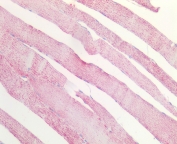 IHC staining of FFPE human skeletal muscle tissue with MDH2 antibody at 5ug/ml. Required HIER: steamed antigen retrieval with pH6 citrate buffer; AP-staining.