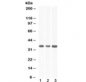 Western blot testing of human 1) HeLa, 2) HepG2 and 3) K562 lysate with MDH2 antibody at 0.03ug/ml. Predicted molecular weight ~35 kDa.