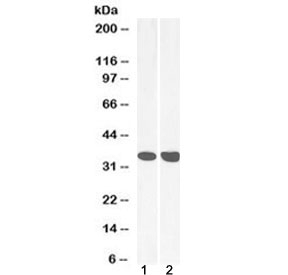 Western blot testing of human 1) heart and 2) liver lysate with MDH2 antibody at 0.03ug/ml. Predicted molecular weight ~35 kDa.~