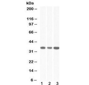 Western blot testing of human 1) HeLa, 2) HepG2 and 3) K562 lysate with MDH2 antibody at 0.03ug/ml. Predic