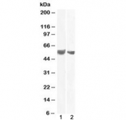 Western blot testing of human 1) placenta and 2) testis lysate with B7-H3 antibody at 0.1 and 2 ug/ml, respectively. Expected molecular weight: 57-110 kDa depending on level of glycosylation.
