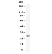 Western blot testing of rat lung lysate with GSTM4 antibody at 0.3ug/ml. Predicted molecular weight ~26 kDa.