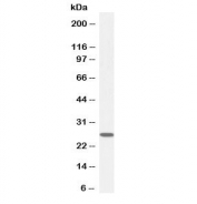 Western blot testing of human HeLa cell lysate with GSTM4 antibody at 0.1ug/ml. Predicted molecular weight ~26 kDa.