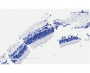 IHC testing of FFPE human retinal without CNGB3 antibody (negative control).