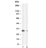 Western blot testing of 1) mouse lung and 2) rat lung lysate with MASH1 antibody at 1ug/ml. Predicted molecular weight ~25 kDa.