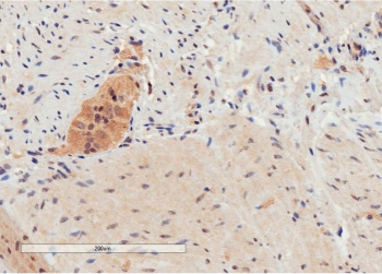 IHC testing of FFPE human colon tissue with GPR120 antibody at 2ug/ml. Specific staining of lymphoid aggregates is seen. HIER: steam section in pH6 citrate buffer for 20 min.~