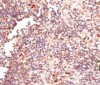 IHC testing of FFPE human lymph node tissue with GLI2 antibody at 4ug/ml. HIER: steam section in pH6 citrate buffer for 20 min.~