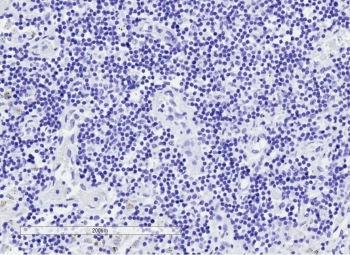 IHC testing of FFPE human lymph node tissue without GLI2 antibody (negative control). HIER: steam section