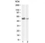 Western blot testing of human 1) lymph node and 2) tonsil tissue lysate with LAG3 antibody at 1ug/ml and 0.5ug/ml, respectively. Predicted molecular weight ~54 kDa.