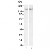 Western blot testing of human 1) Jurkat whole cell and 2) Jurkat nuclear fraction lysate with CTCF antibody at 0.03ug/ml and 0.1ug/ml, respectively. Observed molecular weight: 70/82/130 kDa (referred to as CTCF-70, -82 and -130).