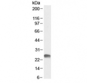 Western blot testing of human placental lysate with GSTA3 antibody at 0.3ug/ml. Predicted molecular weight ~25 kDa.