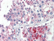 IHC testing of FFPE human testis tissue with SPAG16 antibody at 5ug/ml. HIER: steamed antigen retrieval with pH6 citrate buffer; AP-staining.