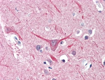 IHC testing of FFPE human brain (cortex) tissue with UBR2 antibody at 5ug/ml. HIER: steamed antigen retrieval with pH6 citrate buffer; AP-staining.