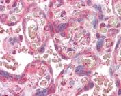 IHC testing of FFPE human placental tissue with ERV3 antibody at 3.75ug/ml. HIER: steamed antigen retrieval with pH6 citrate buffer; AP-staining.