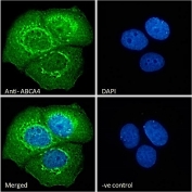 Immunofluorescent staining of fixed and permeabilized human MCF7 cells with ABCA4 antibody (green) at 10ug/ml and DAPI nuclear stain (blue).