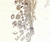 IHC staining of FFPE human small intestine tissue with SGLT1 antibody at 5ug/ml. Required HIER: steamed antigen retrieval with pH6 citrate buffer; HRP-staining.
