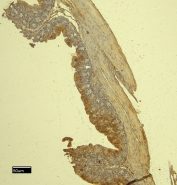 IHC staining of FFPE mouse intestine tissue with Mcpt4 antibody at 8ug/ml. Required HIER: steamed antigen retrieval with pH6 citrate buffer; HRP-staining.