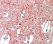 IHC staining of FFPE human cortex tissue with VGLUT1 antibody at 3.75ug/ml. Required HIER: steamed antigen retrieval with pH6 citrate buffer; AP-staining.