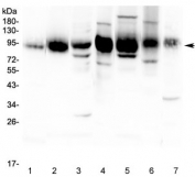 Western blot testing of rat 1) spleen, 2) thymus and 3) RH35 lysate and mouse 4) spleen, 5) thymus, 6) HEPA1-6 and 7) heart lysate with ICAM1 antibody at 0.5ug/ml. Predicted molecular weight: ~58 kDa (unmodified), 75-115 kDa (glycosylated).