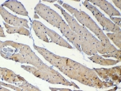 IHC testing of FFPE mouse heart tissue with Dnmt1 antibody at 1ug/ml. Required HIER: steam section in pH6 citrate buffer for 20 min and allow to cool prior to testing.