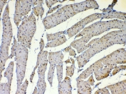 IHC testing of FFPE rat heart tissue with Dnmt1 antibody at 1ug/ml. Required HIER: steam section in pH6 citrate buffer for 20 min and allow to cool prior to testing.
